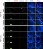 CD206 (MMR) Antibody in Immunocytochemistry (ICC/IF)