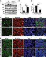 CD324 (E-Cadherin) Antibody in Immunohistochemistry (IHC)