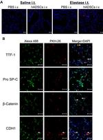 CD324 (E-Cadherin) Antibody in Immunocytochemistry, Immunohistochemistry (ICC/IF, IHC)