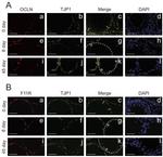 ZO-1 Antibody in Immunohistochemistry (IHC)