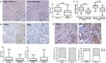 FOXP3 Antibody in Immunohistochemistry (IHC)