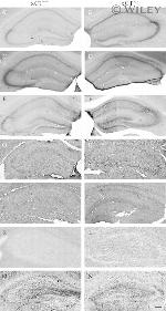 SLC7A11 Antibody in Immunohistochemistry (IHC)