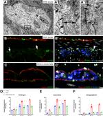 S100A1 Antibody in Immunohistochemistry (IHC)