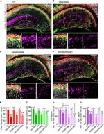 EOMES Antibody in Immunohistochemistry (IHC)