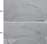 Galectin 3 Antibody in Immunohistochemistry (IHC)