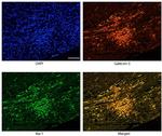 Galectin 3 Antibody in Immunohistochemistry (IHC)