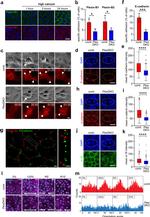 Plexin-B2 Antibody in Immunocytochemistry (ICC/IF)