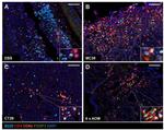 CD4 Antibody in Immunohistochemistry (IHC)