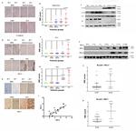 CD274 (PD-L1, B7-H1) Antibody in Immunohistochemistry (IHC)