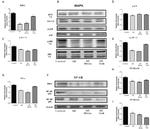 NFkB p50/p105 Antibody in Western Blot (WB)