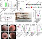 IL-22 Antibody in Neutralization (Neu)