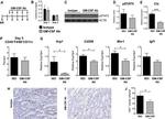 GM-CSF Antibody in Neutralization (Neu)