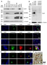 Pan Cytokeratin Antibody in Western Blot (WB)