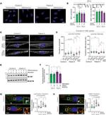 EEA1 Antibody in Immunocytochemistry (ICC/IF)