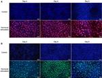 IL-33R (ST2) Antibody in Immunohistochemistry (IHC)