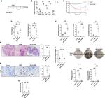 Ly-6G Antibody in Immunohistochemistry (IHC)