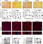 Alpha-Smooth Muscle Actin Antibody in Immunohistochemistry (IHC)