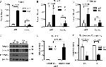 SMAD2 Antibody in Western Blot (WB)