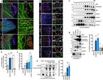 Dynein Antibody in Immunocytochemistry (ICC/IF)