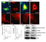 Vinculin Antibody in Western Blot (WB)