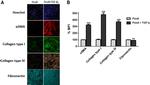 Fibronectin Antibody in Immunocytochemistry (ICC/IF)