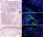 Vimentin Antibody in Immunohistochemistry (IHC)