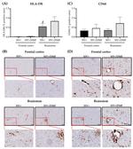 HLA-DR Antibody in Immunohistochemistry (IHC)