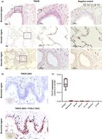 FOXJ1 Antibody in Immunohistochemistry (IHC)