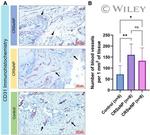 CD31 Antibody in Immunohistochemistry (IHC)