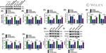 Cyclin D1 Antibody in Western Blot (WB)