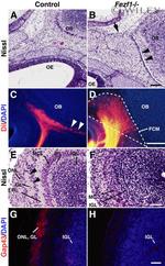 GAP43 Antibody in Immunohistochemistry (IHC)