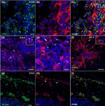 VE-cadherin Antibody in Immunocytochemistry (ICC/IF)