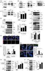 ATP4B Antibody in Western Blot (WB)