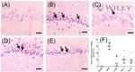 HO-1 Antibody in Immunohistochemistry (IHC)