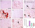 Bax Antibody in Immunohistochemistry (IHC)