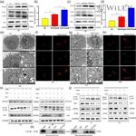 NCOA4 Antibody in Western Blot, Immunoprecipitation (WB, IP)