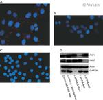 AKT2 Antibody in Western Blot (WB)