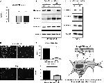 IL-6 Antibody in Neutralization (Neu)