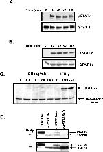 STAT5 alpha/beta Antibody in Western Blot (WB)