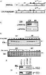 STAT5 alpha/beta Antibody in Western Blot (WB)