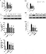 TLR4 Antibody in Western Blot (WB)