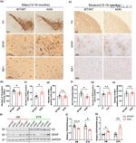 IBA1 Antibody in Immunohistochemistry (IHC)