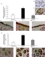 HSP90 beta Antibody in Immunohistochemistry (IHC)