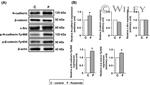 beta Catenin Antibody in Western Blot (WB)