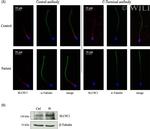 SLC9A10 Antibody in Western Blot (WB)