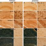 Synapsin 1 Antibody in Immunohistochemistry (IHC)