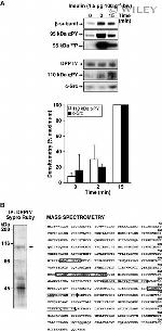 CD26 Antibody in Immunoprecipitation (IP)