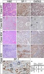 NR5A1 Antibody in Immunohistochemistry (IHC)