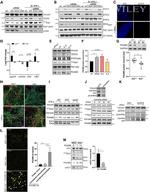 STAT5 beta Antibody in Immunocytochemistry (ICC/IF)