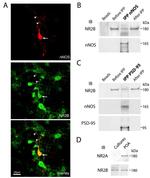 NMDAR2B Antibody in Western Blot, Immunocytochemistry (WB, ICC/IF)